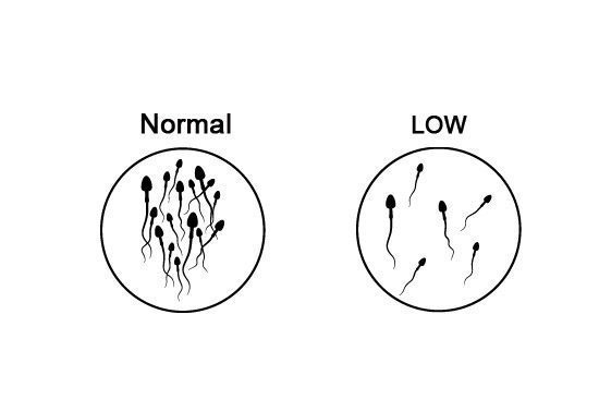 Decline in sperm counts